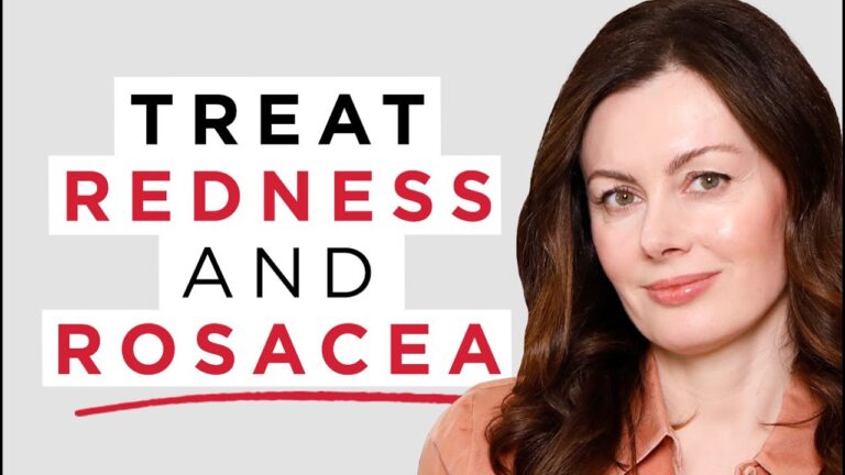 Discover the Best Skin Rosacea Treatment: Effective Tips and Methods