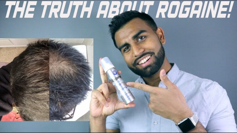 10 Real-Life Rogaine Reviews: Does It Work for Hair Loss or Just a Scam?