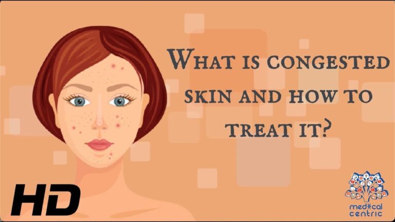 10 Telltale Signs of Congested Skin – How to Identify and Treat Them
