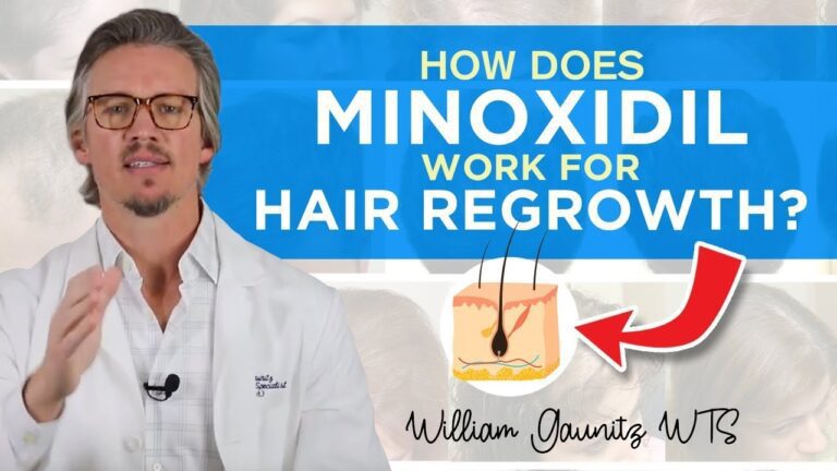 Unlock Fuller & Healthier Hair with Minoxidil Serum – The Ultimate Solution!