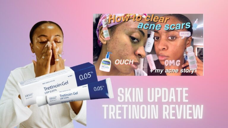 Everything You Need to Know About Tretinoin: Reviews, Results and Expert Opinions