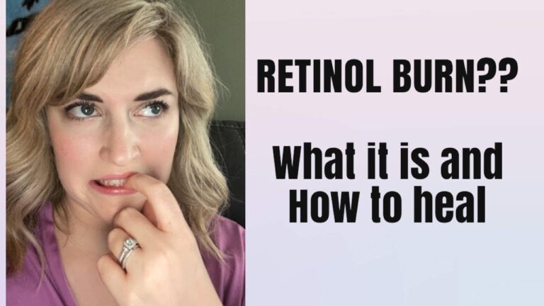 How to Prevent and Treat Retinol Burns: A Comprehensive Guide