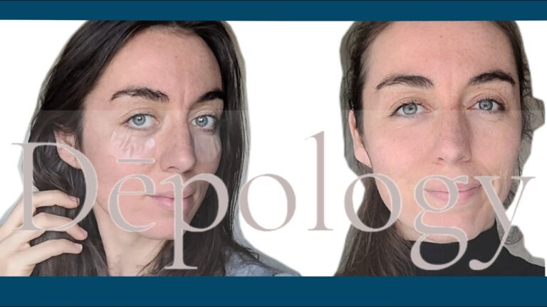 Matrixyl 3000 Before and After: The Ultimate Skin Transformation