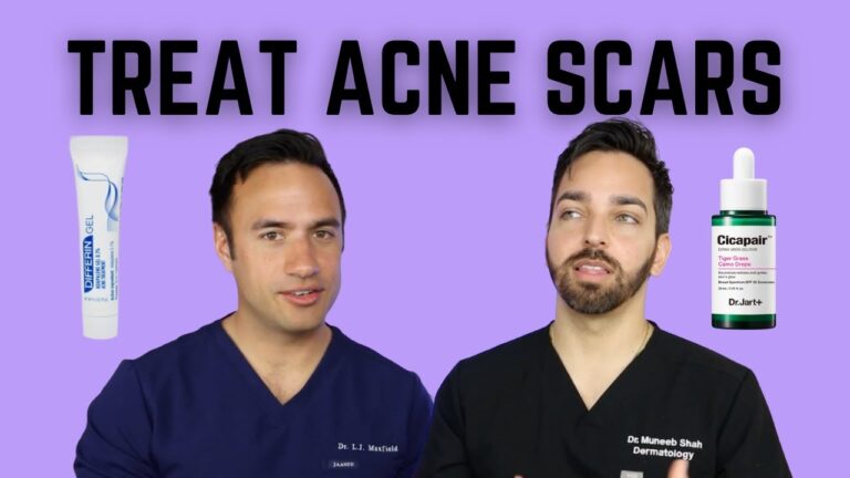 Battle Acne Scars with these Expert Remedies – Our Complete Guide