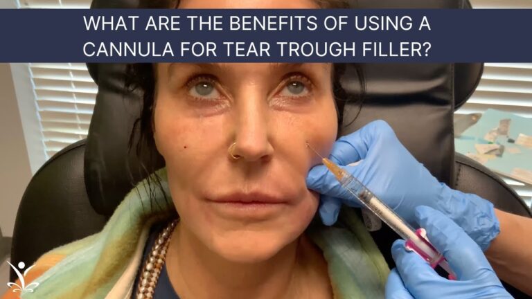 Say Goodbye to Dark Circles with Hyaluronic Acid – The Ultimate Solution