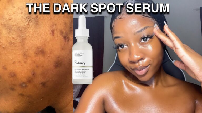 Saying Goodbye to Dark Spots: Effective Solutions to Brighten Your Skin