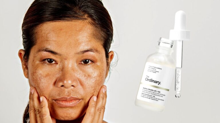 Discover the Power of Ordinary Alpha Arbutin 2 + HA for Flawless Skin