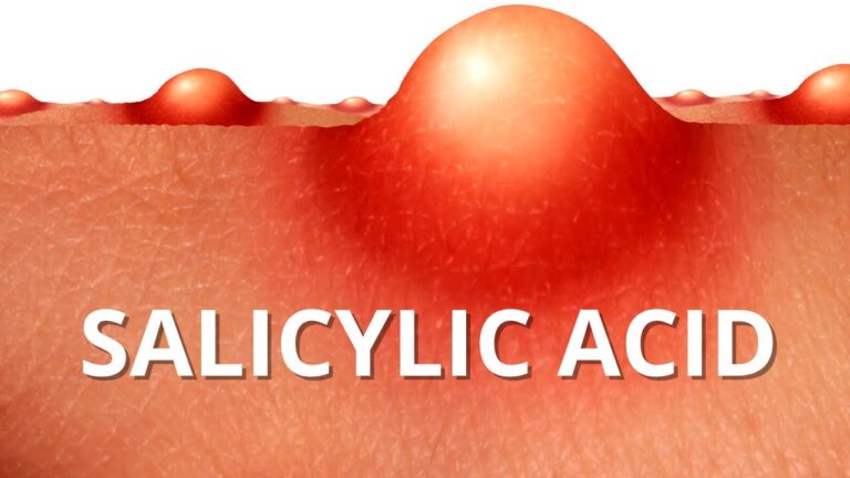Maximizing the Benefits: How Long Should You Leave Salicylic Acid on Your Face?