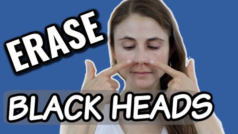 10 Effective Skin Blackhead Treatments You Need to Know in 2021