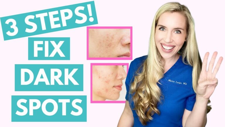 Say Goodbye to Dark Spots with Our Effective Removal Treatment