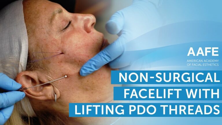 10 proven non-surgical facelift treatments for a younger-looking you