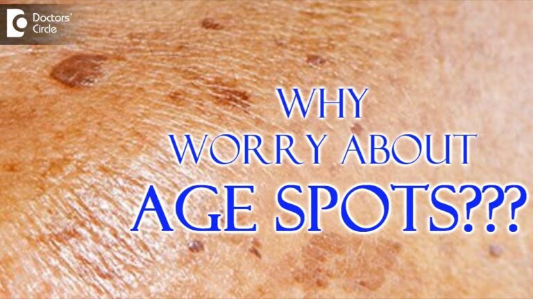 5 Proven Methods for Effective Skin Age Spot Removal