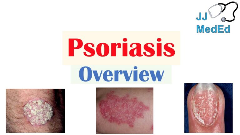 10 Effective Skin Psoriasis Treatment Options for Clearer Skin