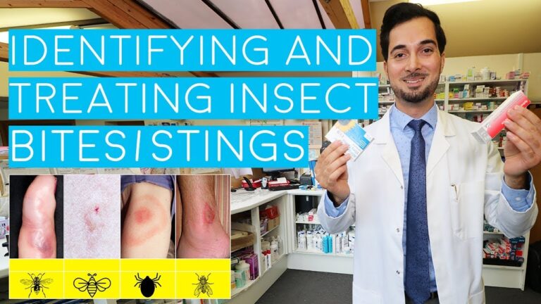Effective Skin Insect Bite Treatment: Tips and Remedies to Soothe Your Skin Quickly