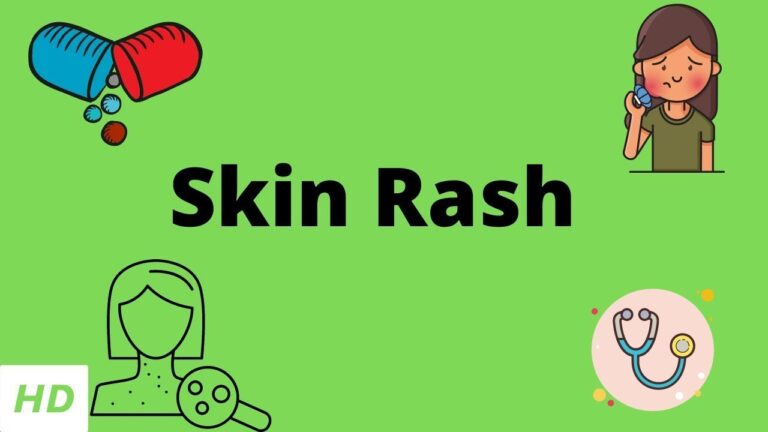Effective Skin Rash Treatment: Tips and Home Remedies for Quick Relief