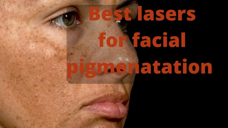 Get Flawless Skin: Effective Methods for Pigmentation Removal