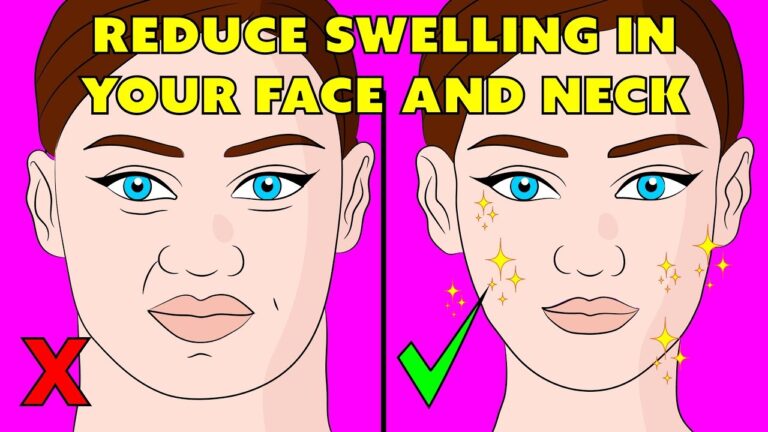 Say Goodbye to Puffy Eyes: Simple Remedies that Work!