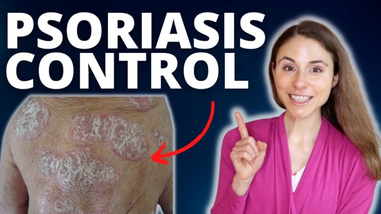 Top 10 Highly Effective Skincare Products for Psoriasis Relief