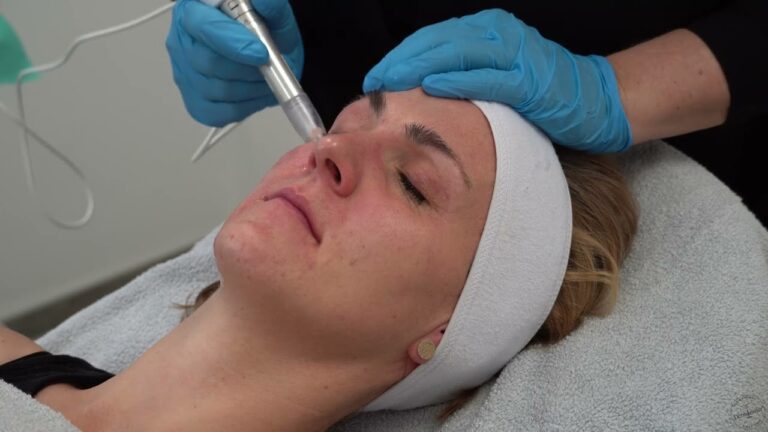 Unlock the Secrets to Youthful Skin with Effective Collagen Treatments